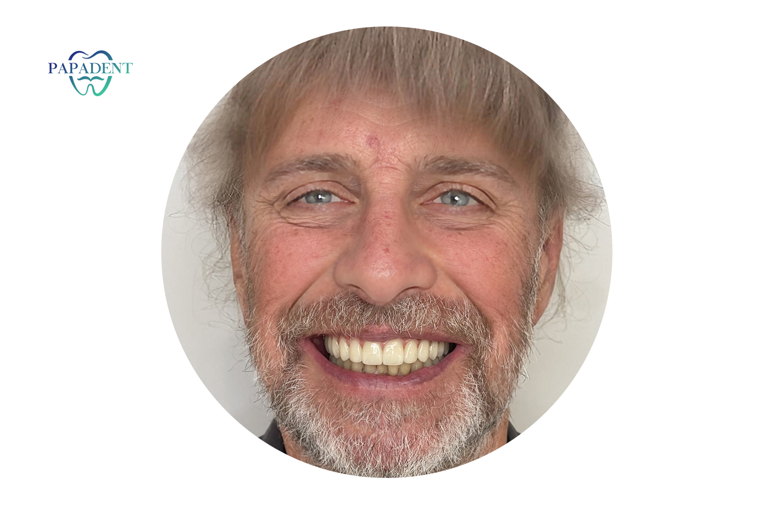 История успеха Дайнюса в программе 